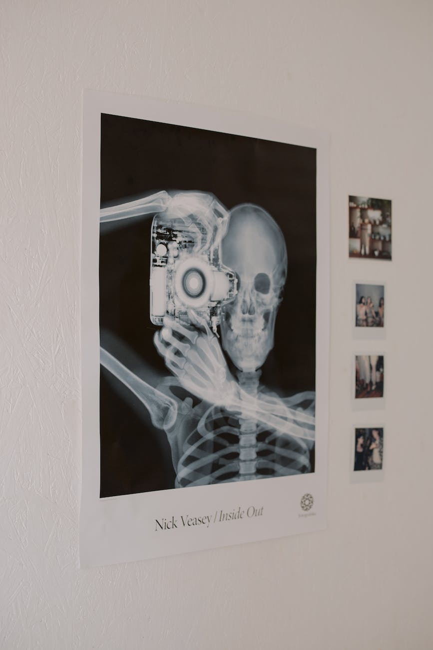 What looks like a serious x-ray is actually a playful skeleton holding a camera, ready to take your picture