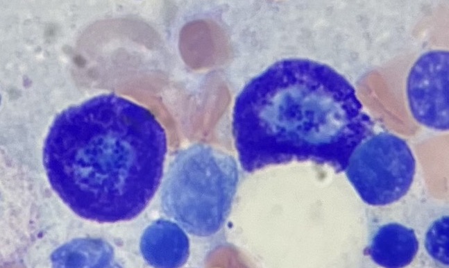 Two plump mast cells, dyed a bright cobalt blue, swim amongst pink and white bone marrow cells.